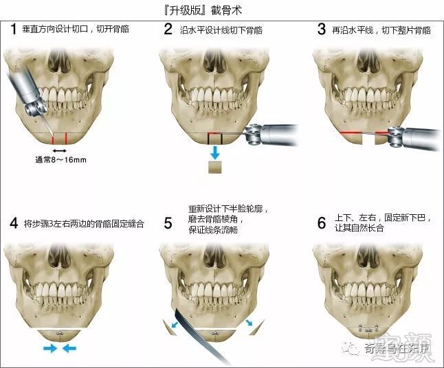 案例图片