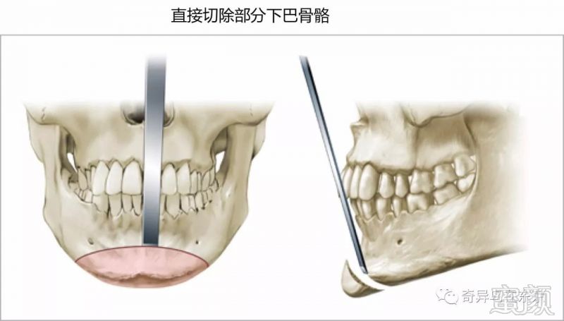 案例图片