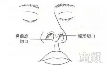 https://img.miyanlife.com/mnt/timg/171201/12020632T-11.jpg