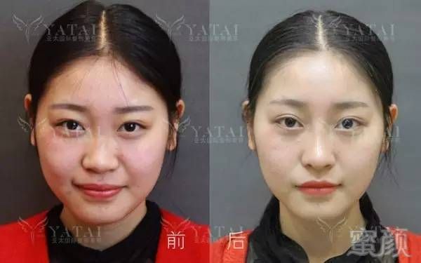 https://img.miyanlife.com/mnt/timg/171201/12120R091-8.jpg