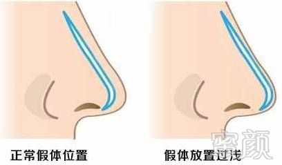 https://img.miyanlife.com/mnt/timg/171201/12120T016-7.jpg