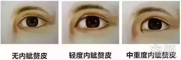 案例图片