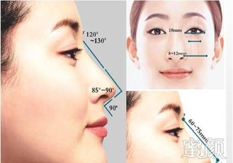 https://img.miyanlife.com/mnt/timg/171201/125R55247-1.jpg