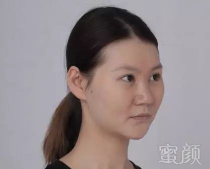 https://img.miyanlife.com/mnt/timg/171201/13004JK8-3.jpg