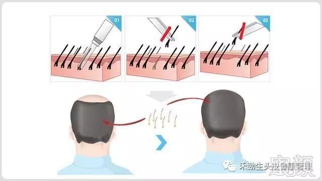 https://img.miyanlife.com/mnt/timg/171201/133SV012-3.jpg