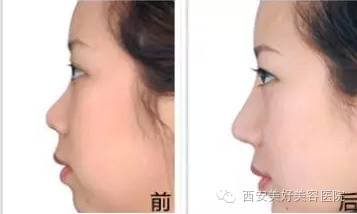 https://img.miyanlife.com/mnt/timg/171201/134Z11923-3.jpg