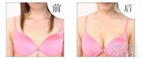 https://img.miyanlife.com/mnt/timg/171201/134Z25X6-7.jpg