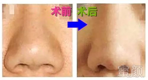 https://img.miyanlife.com/mnt/timg/171201/1353252P1-3.jpg