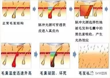 案例图片