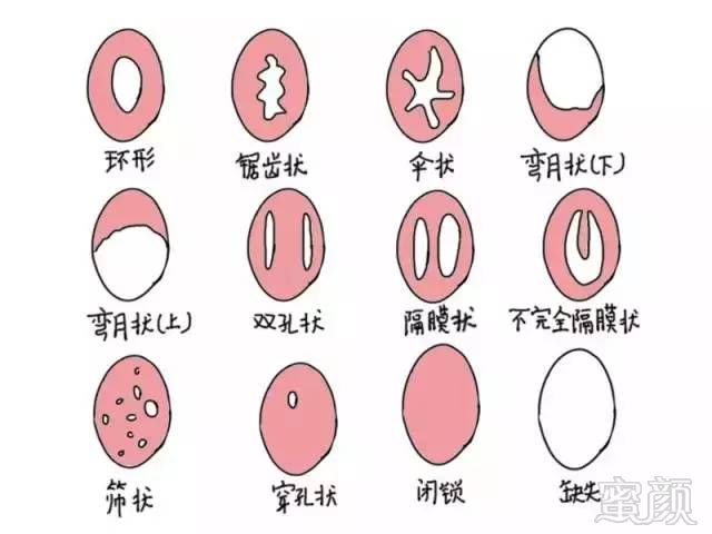 https://img.miyanlife.com/mnt/timg/171202/12015RF7-7.jpg