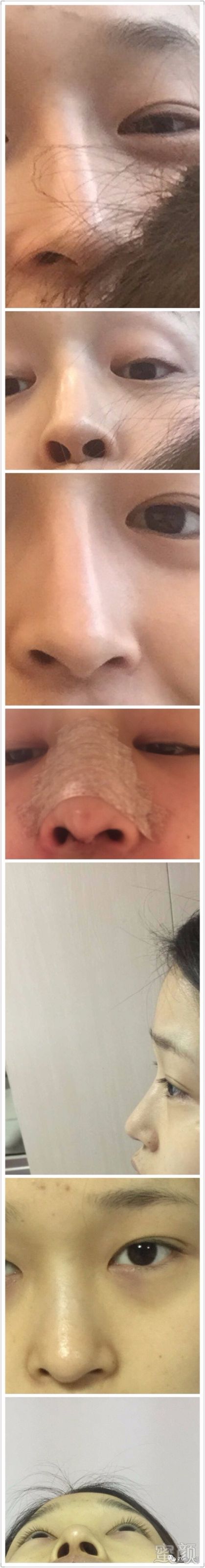 https://img.miyanlife.com/mnt/timg/171202/133KMQ4-0.jpg