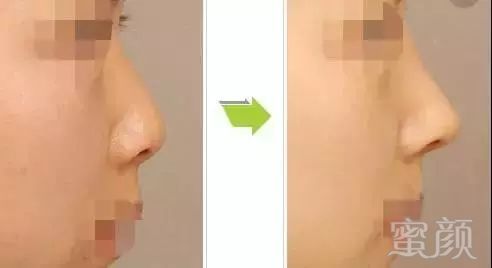 https://img.miyanlife.com/mnt/timg/171202/1455015340-5.jpg