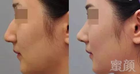 https://img.miyanlife.com/mnt/timg/171202/145501C35-7.jpg
