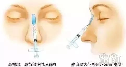 https://img.miyanlife.com/mnt/timg/171202/145501F63-3.jpg