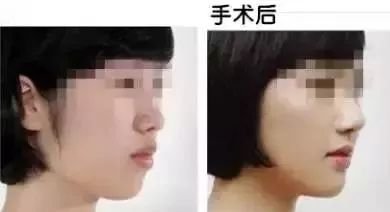 https://img.miyanlife.com/mnt/timg/171202/1455021147-9.jpg