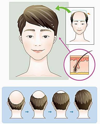 https://img.miyanlife.com/mnt/timg/171203/094A232b-1.jpg
