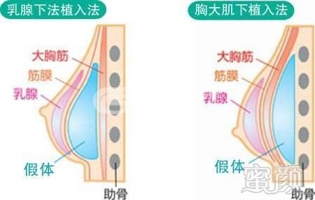 案例图片