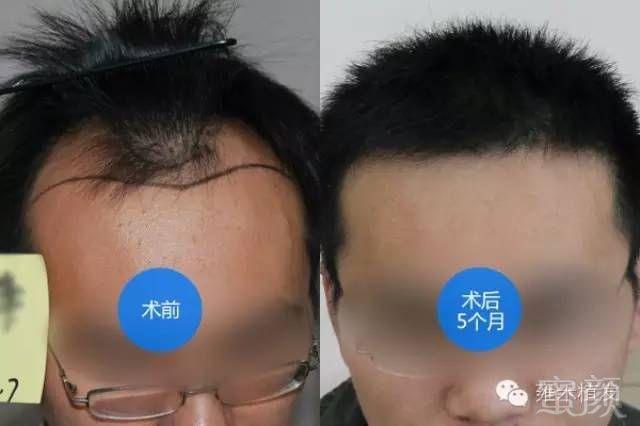 https://img.miyanlife.com/mnt/timg/171204/1015114013-0.jpg