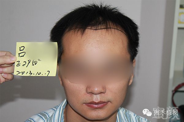 https://img.miyanlife.com/mnt/timg/171204/1015122025-1.jpg
