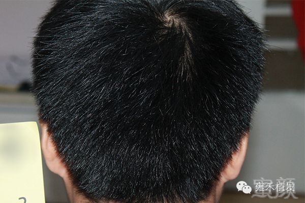 https://img.miyanlife.com/mnt/timg/171204/1015132B6-4.jpg