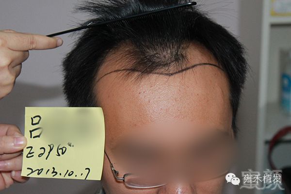 https://img.miyanlife.com/mnt/timg/171204/1015134457-3.jpg