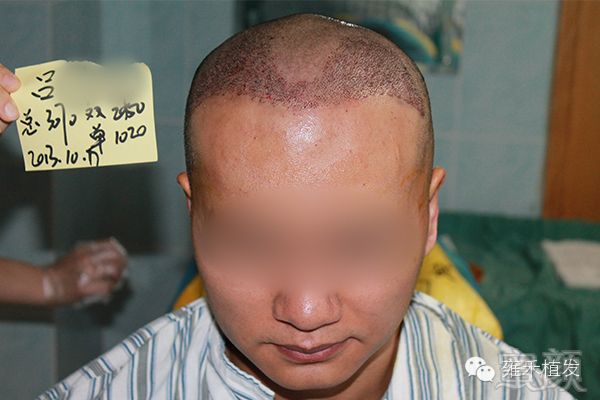 https://img.miyanlife.com/mnt/timg/171204/10151LQ0-8.jpg