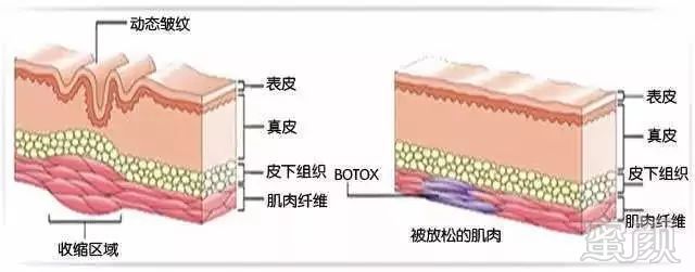 案例图片