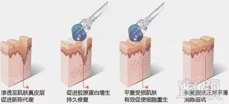 案例图片