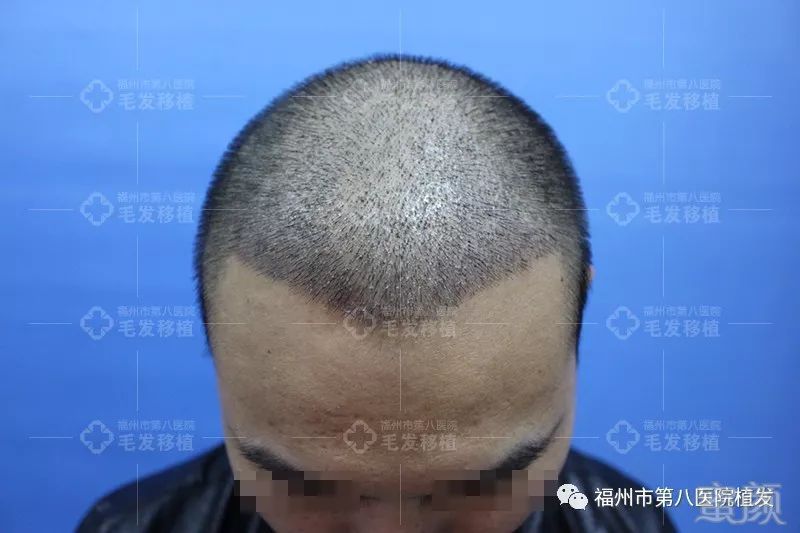 https://img.miyanlife.com/mnt/timg/171205/11521T4C-4.jpg