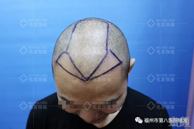 https://img.miyanlife.com/mnt/timg/171205/11521U392-3.jpg