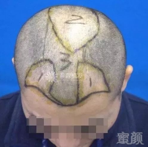 https://img.miyanlife.com/mnt/timg/171205/1153191H2-2.jpg
