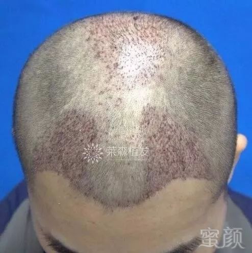 https://img.miyanlife.com/mnt/timg/171205/115319CQ-3.jpg