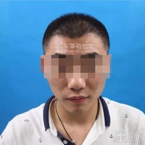 https://img.miyanlife.com/mnt/timg/171205/1153201563-7.jpg