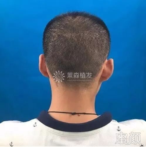 https://img.miyanlife.com/mnt/timg/171205/1153202O0-9.jpg