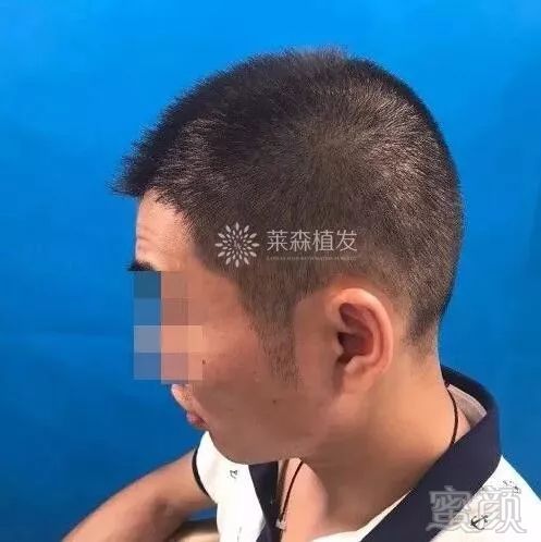 https://img.miyanlife.com/mnt/timg/171205/115320JQ-8.jpg