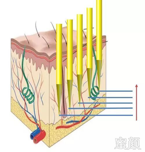 https://img.miyanlife.com/mnt/timg/171205/1225553191-5.jpg