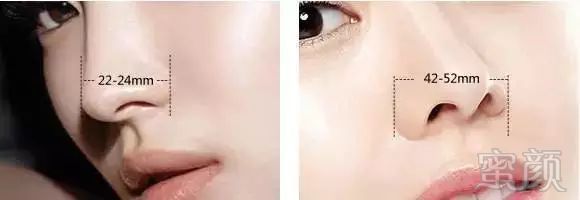 https://img.miyanlife.com/mnt/timg/171205/1234254c0-5.jpg