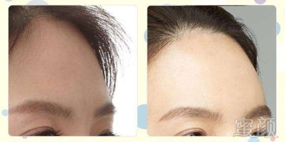 https://img.miyanlife.com/mnt/timg/171205/13125R1A-3.jpg