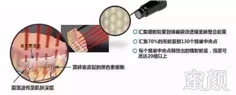 https://img.miyanlife.com/mnt/timg/171205/1330312144-12.jpg
