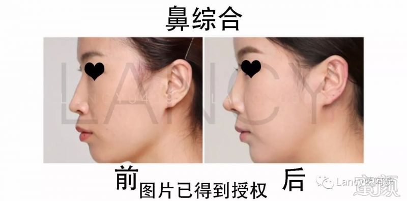 https://img.miyanlife.com/mnt/timg/171206/112K0DI-1.jpg