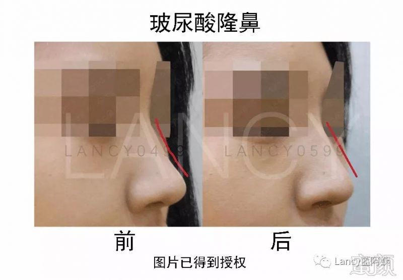 https://img.miyanlife.com/mnt/timg/171206/112K14M4-5.jpg