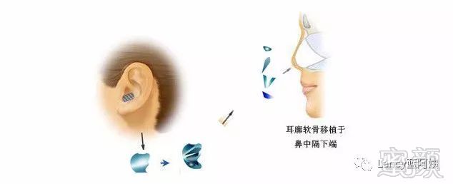 https://img.miyanlife.com/mnt/timg/171206/112K2J57-6.jpg