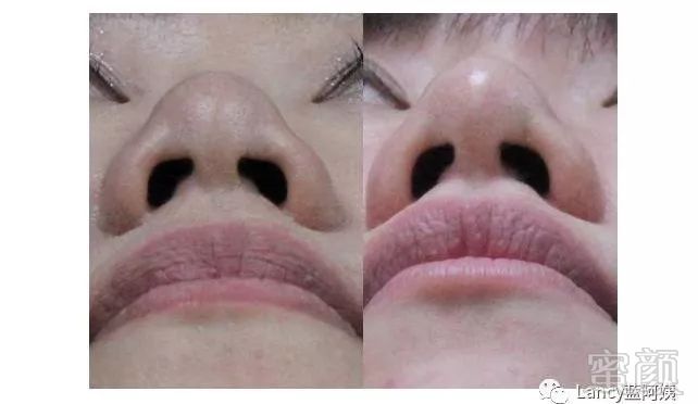 https://img.miyanlife.com/mnt/timg/171206/112K2N22-9.jpg