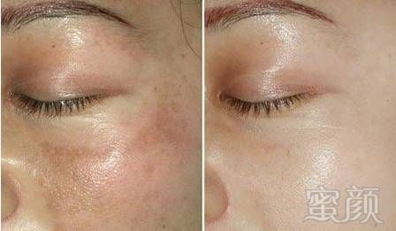 https://img.miyanlife.com/mnt/timg/171206/142P53948-5.jpg