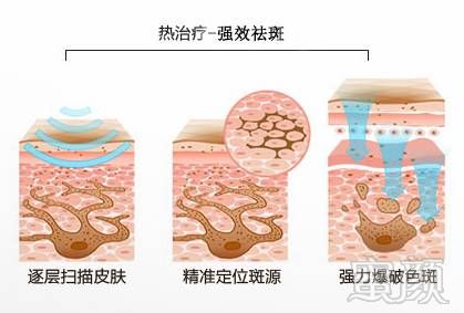 https://img.miyanlife.com/mnt/timg/171206/142P561J-1.jpg