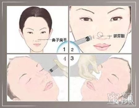 https://img.miyanlife.com/mnt/timg/171206/142R41B3-0.jpg