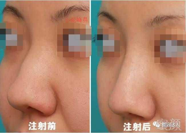 https://img.miyanlife.com/mnt/timg/171206/142R461K-3.jpg