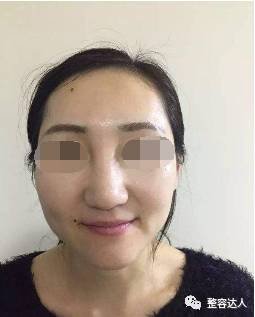 https://img.miyanlife.com/mnt/timg/171206/142R46358-1.jpg