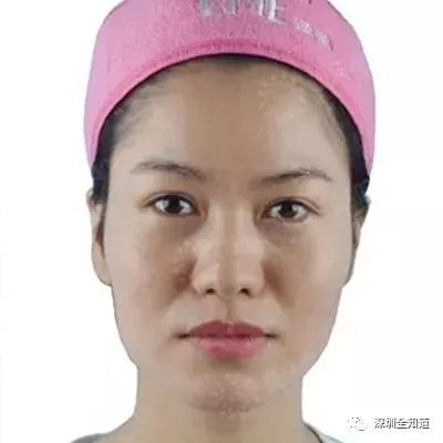 https://img.miyanlife.com/mnt/timg/171207/11542064S-0.jpg