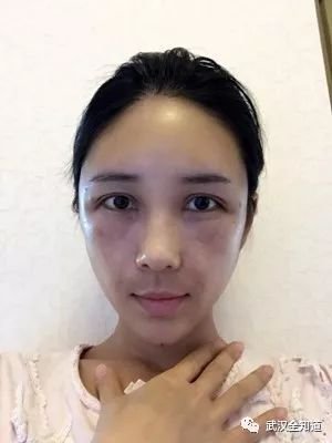 https://img.miyanlife.com/mnt/timg/171207/1203103516-1.jpg